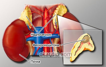 Tensiune arterială crescută din motive de sarcină, cum să scadă decât periculoasă