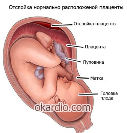Tensiune arterială crescută din motive de sarcină, cum să scadă decât periculoasă