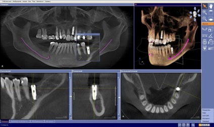 Posibilitățile de tomografie gallileos, centrul de tomografie computerizată dentară