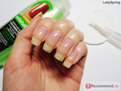 Lichid pentru îndepărtarea anticorozivului de gel-lactic, antishellac - 