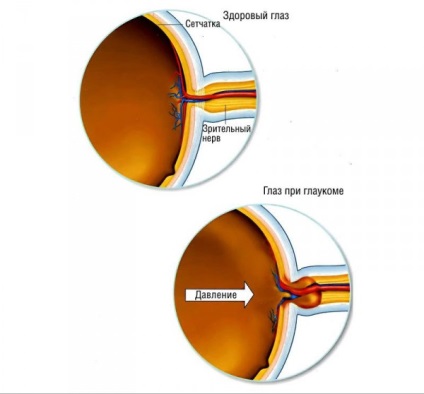 Structura nervului optic, funcția, patologia