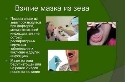 Angina și acoperirea albă a amigdalelor - cum să eliminați și să eliminați petele - să trăiți sănătoși