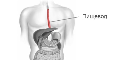 Boala gâtului cu esofagită de reflux, ce se spune și cum se tratează