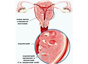 Borovoy proprietăți uterine medicinale și contraindicații