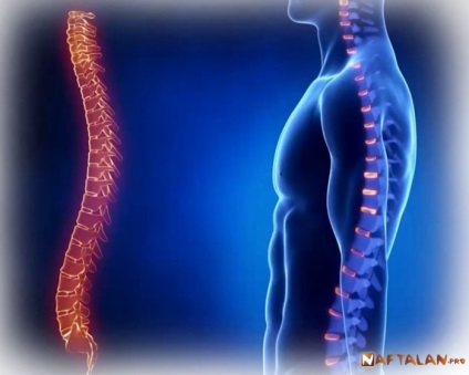 Spondylosis deformálódása