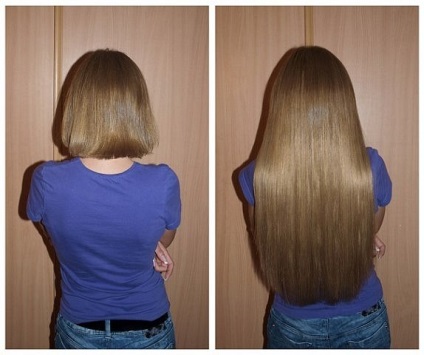 Dimexid pentru creșterea părului - cum este să folosiți fotografia înainte și după?