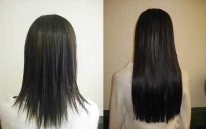Dimexide a haj növekedéséhez - mi a célja a fotó használata előtt és után?