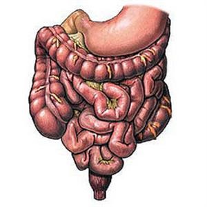 Dolihomegakolon simptome, semne, diagnostic și tratament