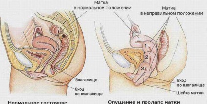 Фолікулін (естрон) спосіб застосування і опис