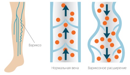 Tratamentul sinuzitelor și cauzele - centru - osteopat