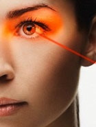 Schimbarea culorii ochilor va ajuta la știrile portalului de frumusețe laser
