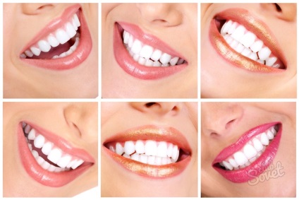 Cum să vă albiți dinții pentru o zi