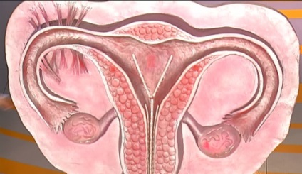 Cum să rămâneți gravidă cu un uter cu două coarne