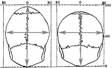 Craniometry vagy a koponya helyes mérése