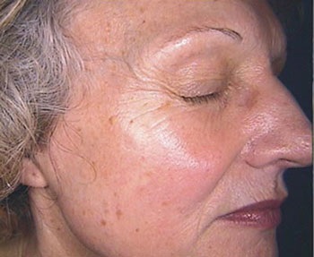 Îmbătrânire și superioritate a cremelor de față de la revizuirile Eivon, întinerirea pielii