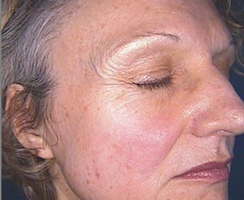 Îmbătrânire și superioritate a cremelor de față de la revizuirile Eivon, întinerirea pielii