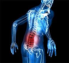 Tratamentul durerilor de spate, medicina populară