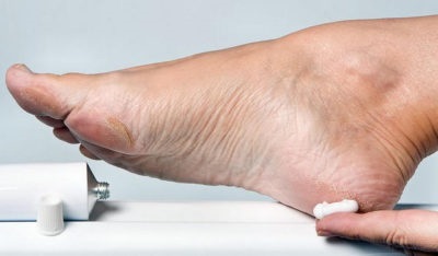 Tratamentul rănilor la nivelul picioarelor cu diabet zaharat