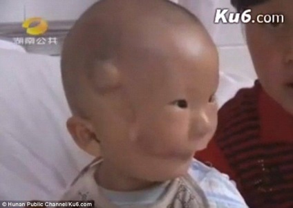 Băiatul sa născut cu o mască pe față - fotografie video