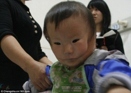 Băiatul sa născut cu o mască pe față - fotografie video