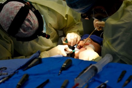 Consecințe neașteptate ale intervențiilor chirurgicale