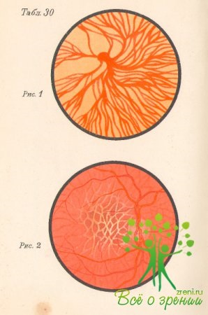 Fundus ocular normal