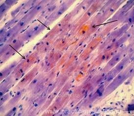 Dystrofii parenchimatoase - practica histologului - informații despre sănătate