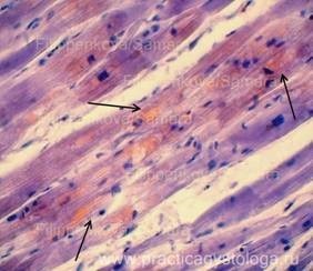 Dystrofii parenchimatoase - practica histologului - informații despre sănătate