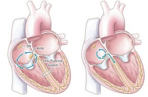 Primul ajutor pentru tahicardie este tratamentul cardiac