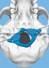 Prima vertebra de col uterin