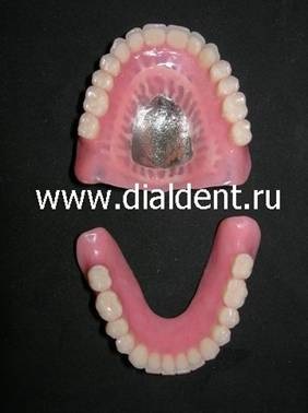 Proteze dentare complete - aproape uitat arta dentară