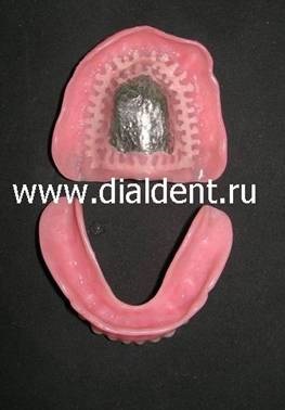 Proteze dentare complete - aproape uitat arta dentară