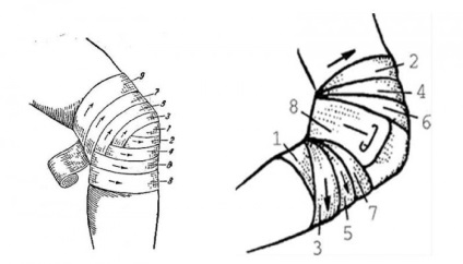 Bandaj de bastonaș, tehnica de fixare a bandajării