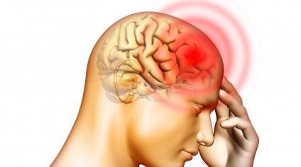 Симптомите на мигрена при мъжете - как да се проявяват мигренозен пристъп