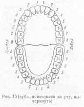 Proteză dentară lamelară detașabilă, stomatologie ortopedică