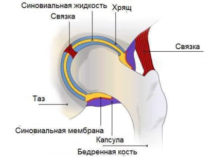 Silovita de șold - simptome, diagnostic și tratament