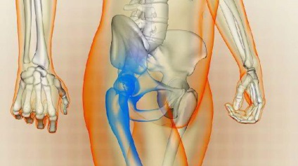 Silovita de șold - simptome, diagnostic și tratament