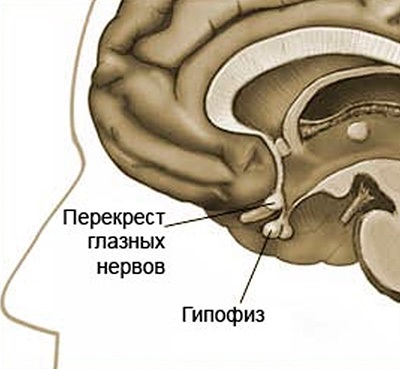 Видалення аденоми гіпофіза методи лікування і реабілітація після операції