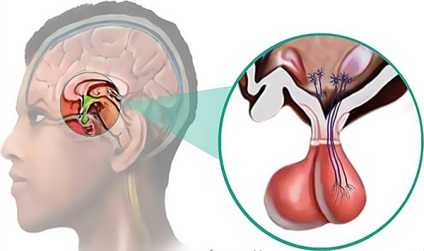 Eliminarea metodelor de tratare și reabilitare a adenomului hipofiza după intervenție chirurgicală