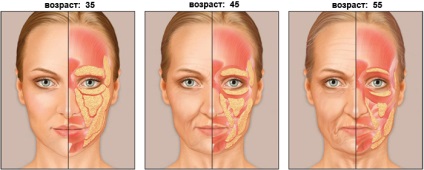 3D-s liposculpturing a test - fenék és a has