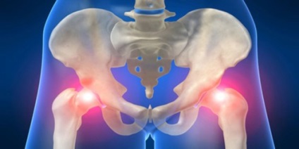 Az arthrosis ízületei klinikai tüneteket mutatnak