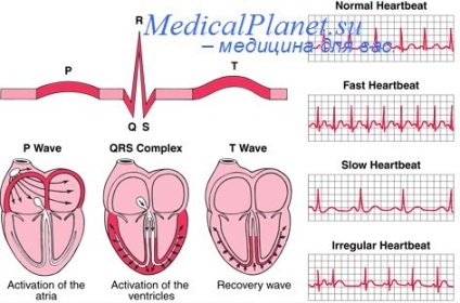 Ce este o electrocardiogramă electrocardiografică