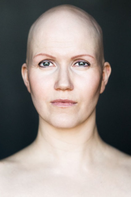 În jos cu canoanele și stereotipurile, șapte portrete magnifice ale fetelor care suferă de alopecie