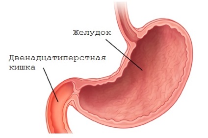 Duodenita ce este prevenirea simptomelor tratamentului