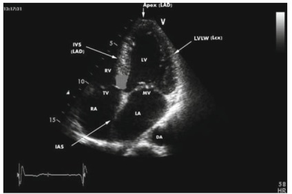 Ecocardiografie, doctorul Kamsky