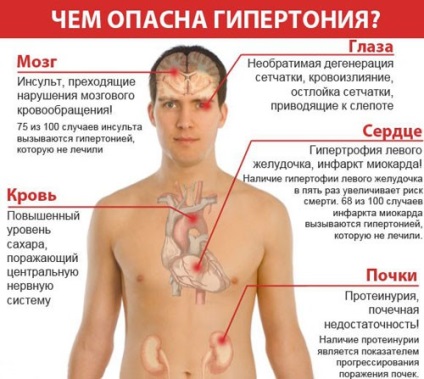 Principalele cauze ale hipertensiunii arteriale la bărbați