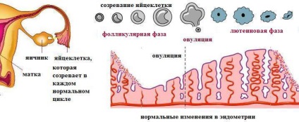 Infertilitatea hormonală