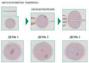 Ixi ce este - sarcina și nașterea - catalog de articole - sănătatea femeilor și ginecologia