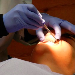 Implantarea dinților sub anestezie în Sankt Petersburg - centrul super-zâmbetului