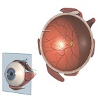 Bolile ischemice ale retinei și ale nervului optic - cât de periculoase, cum să tratăm